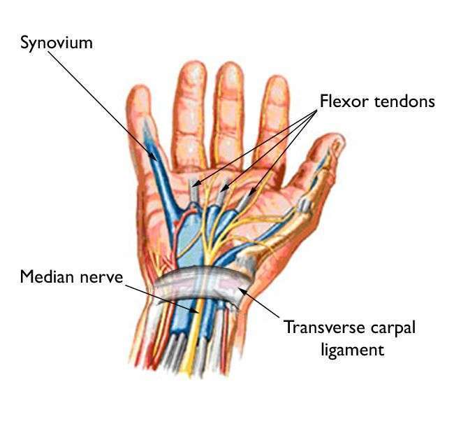 Carpal Tunnel Syndrome Treatment in Chennai